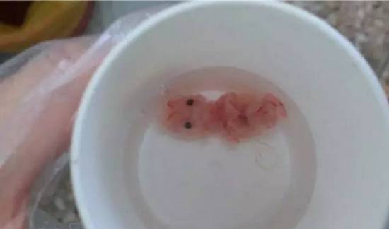 未成年女性多次流产与性健康问题：民营医院